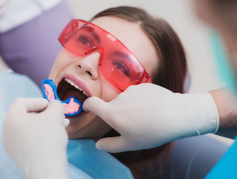 Could Fluoride Treatment Benefit You?