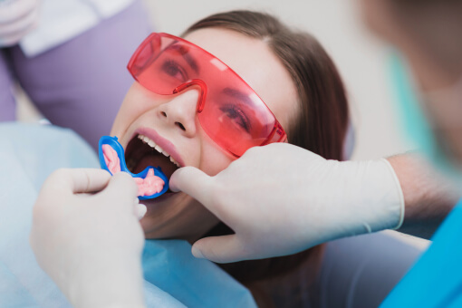 Fluoride Treatment